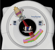 螺旋放疗(TomoTherapy)